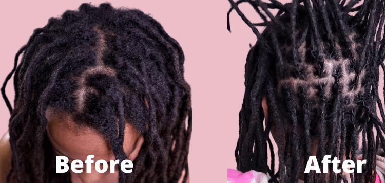 Interlock Dreads before and after