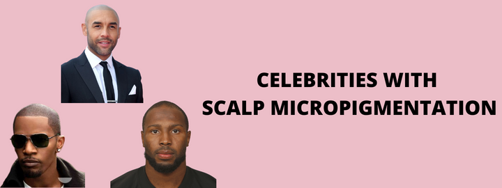 Celebrities With Scalp Micropigmentation
