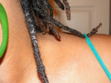 Preventing-Lint-in-the-Starter-Locs